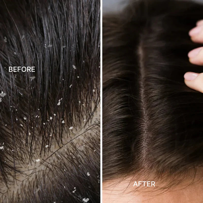 Red Light Scalp Care & Hair Revitalization