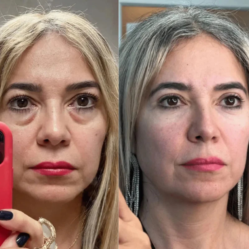 Almanzashop Eye Massager