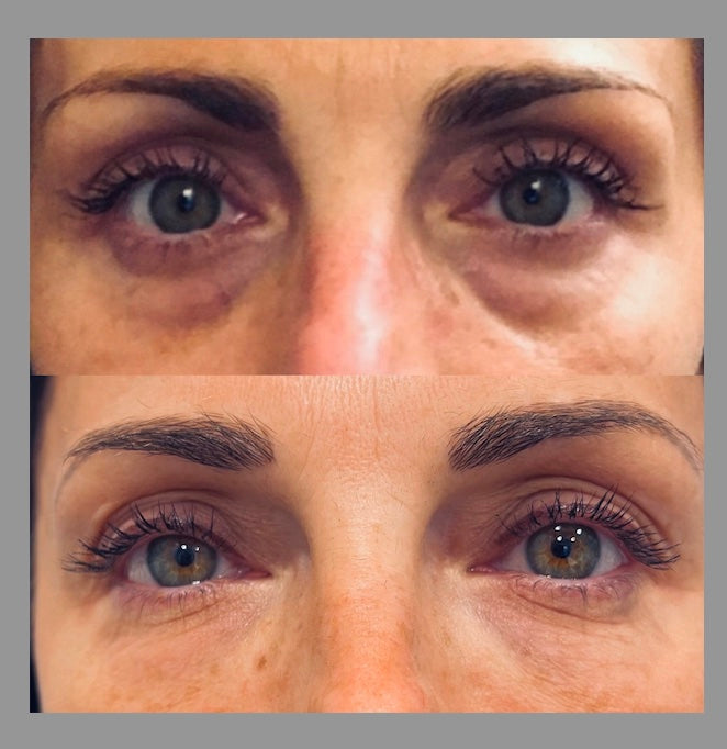 Almanzashop Eye Massager